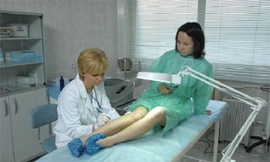 как за лечение на разширени вени по краката